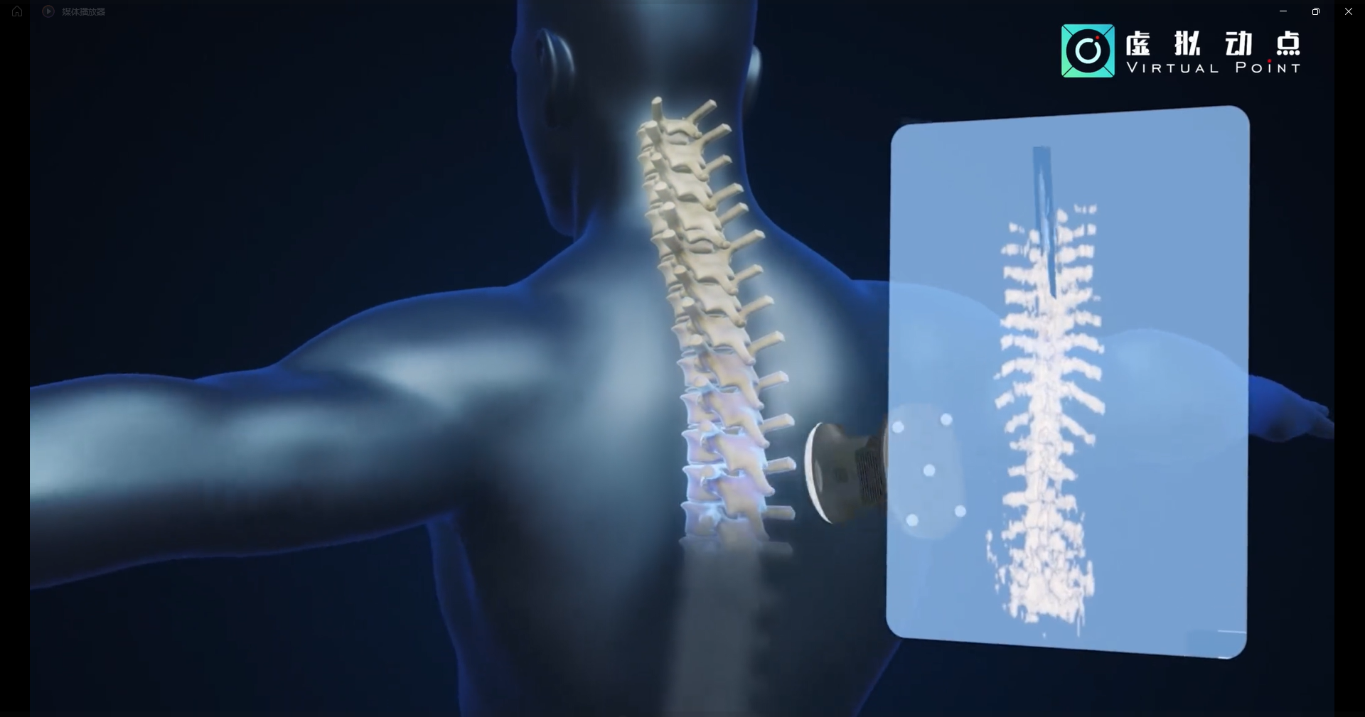 利亚德·虚拟动点OptiTrack开创3D超声成像在脊柱诊断中的应用